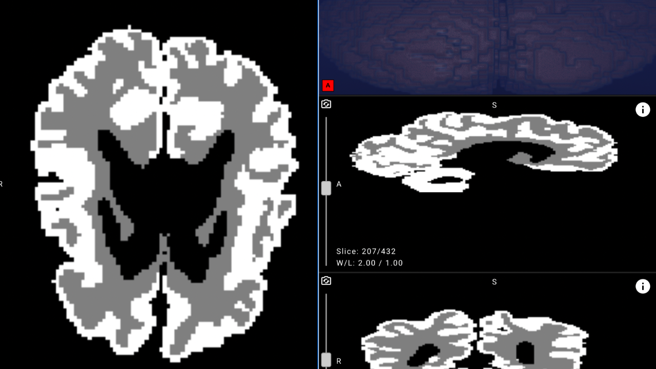bebek beynini analiz eden yapay zeka erken teshisi kolaylastiriyor awcgwy96.png