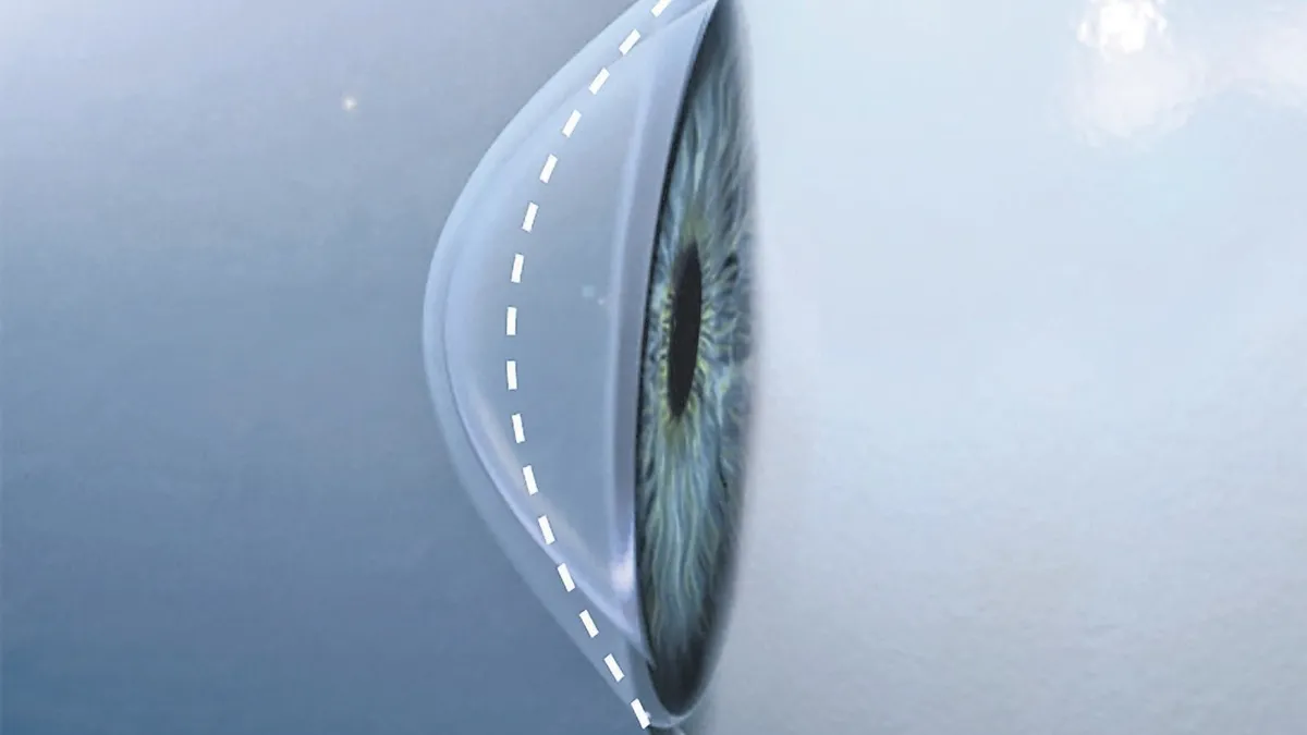 Sık sık gözünü ovuşturanlar dikkat!